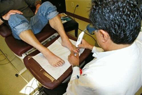 Rimozione dei funghi dalle unghie con il laser